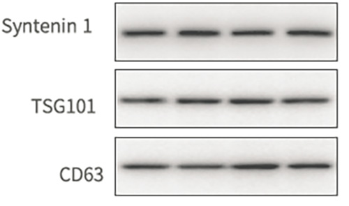 外泌体Western Blot图(Tian Su et al., ACS Nano. 2019)